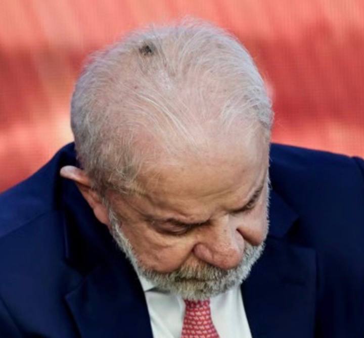 Presidente Lula está internado no Hospital 🏥 Sírio Libanês